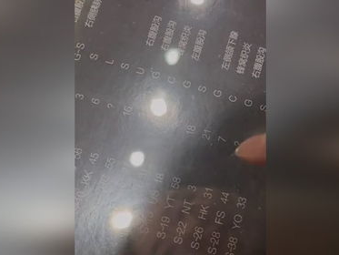 幼童与死神抗争21天：鼠疫阴影下的生命奇迹